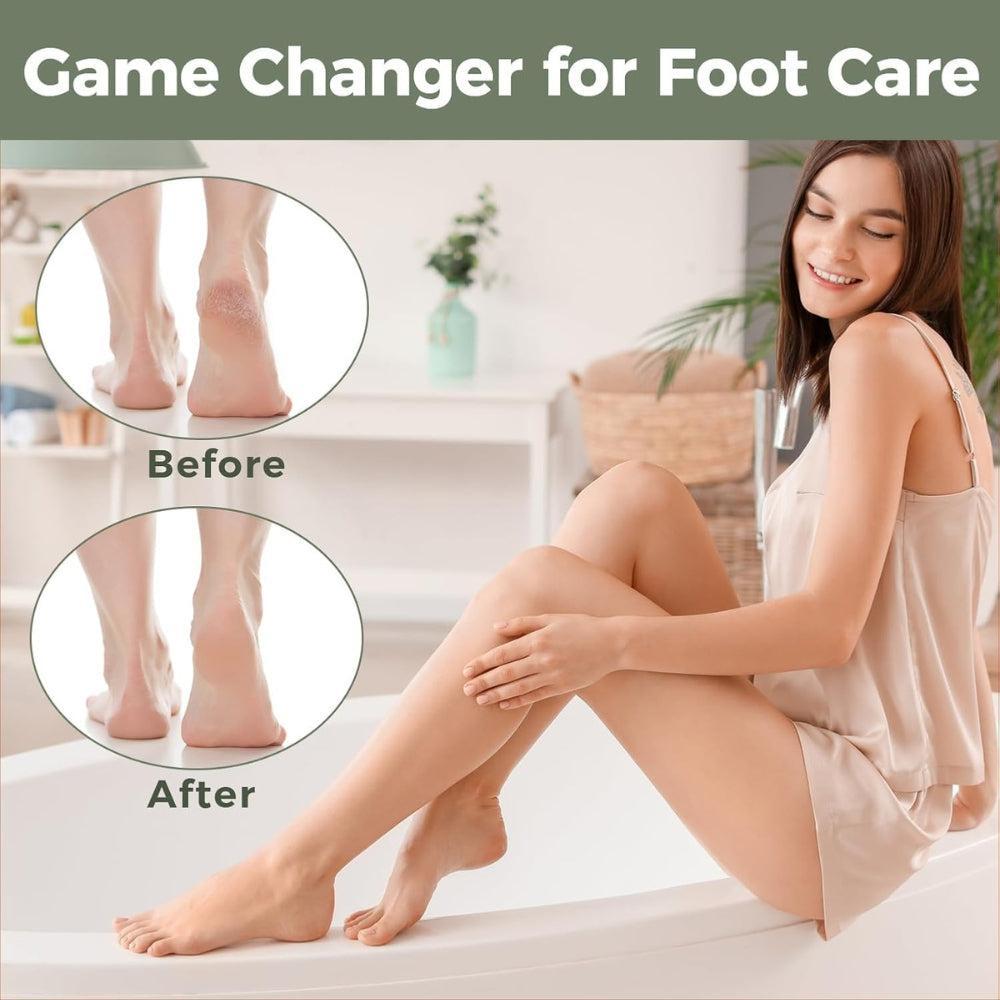 Hard Skin Removal Feet - Stainless Steel Foot File for Dead Skin Remover, Professional Callus Remover for Wet And Dry Feet,White