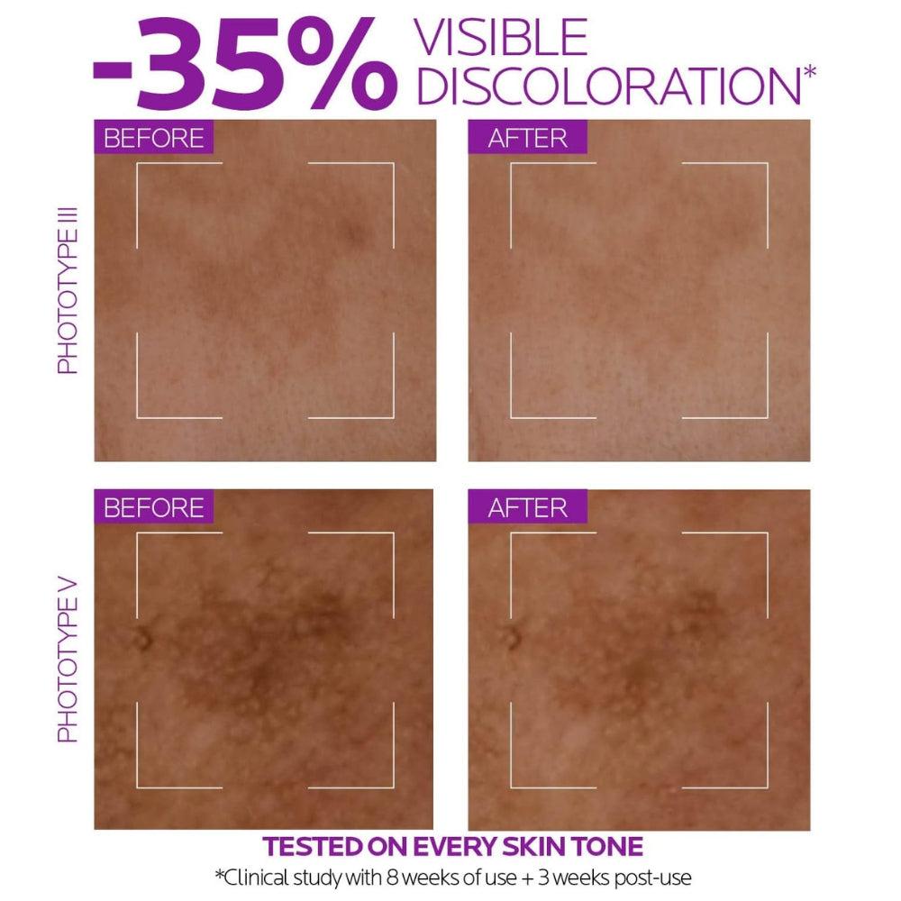 La Roche Posay Anti-Spot Facial Serum Pure Niacinamide 10 30 ml